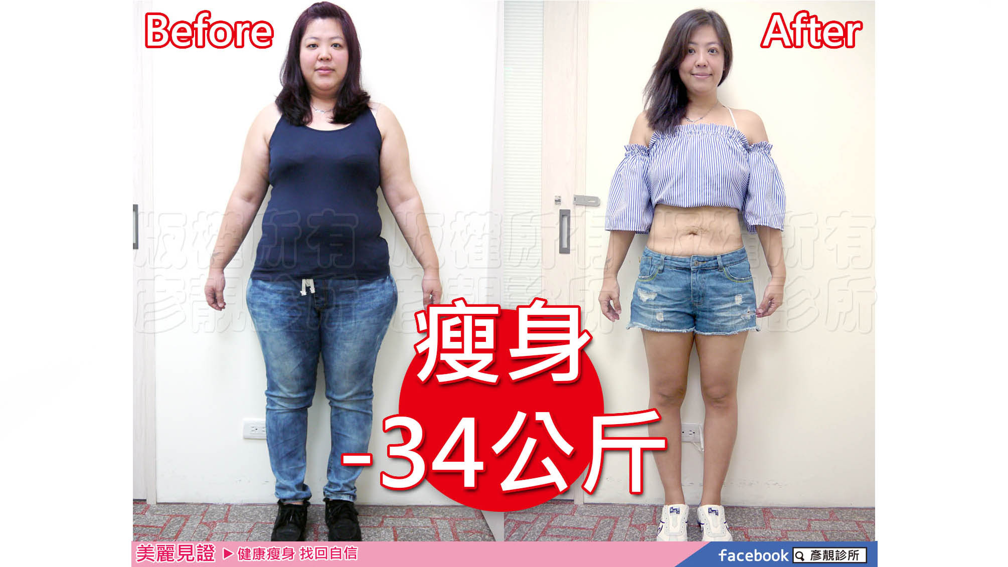 【減重瘦身】酪梨型肥胖身材成功瘦身-34公斤，大象腿都變瘦了